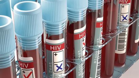 Mulher  terceira curada de HIV no mundo, dizem cientistas